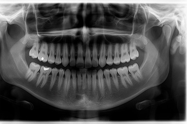 Radiografía panorámica ejemplo
